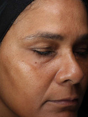 Image of face before using product